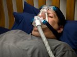 Picture of Sleep Apnea and Obesity with CPAP