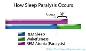 Sleep Paralysis Causes