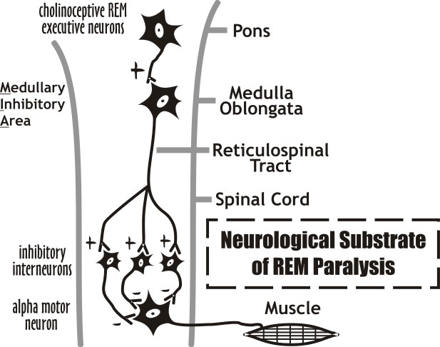 REM Paralysis, or REM Atonia