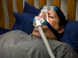 Picture of Sleep Apnea and Obesity with CPAP