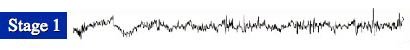 Brain Activity of Non-REM Sleep Stage 1