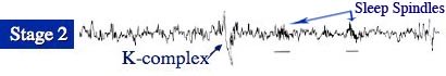 Brain Activity of Non-REM Sleep Stage 2