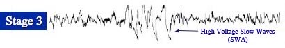 Brain Activity of Non-REM Sleep Stage 3