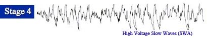 Brain Activity of Non-REM Sleep Stage 4